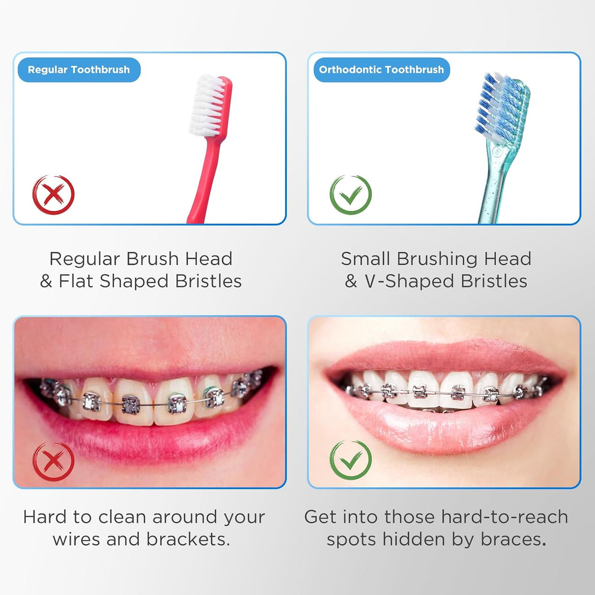 Orthodontic Toothbrush Set with Interdental Brushes encalife