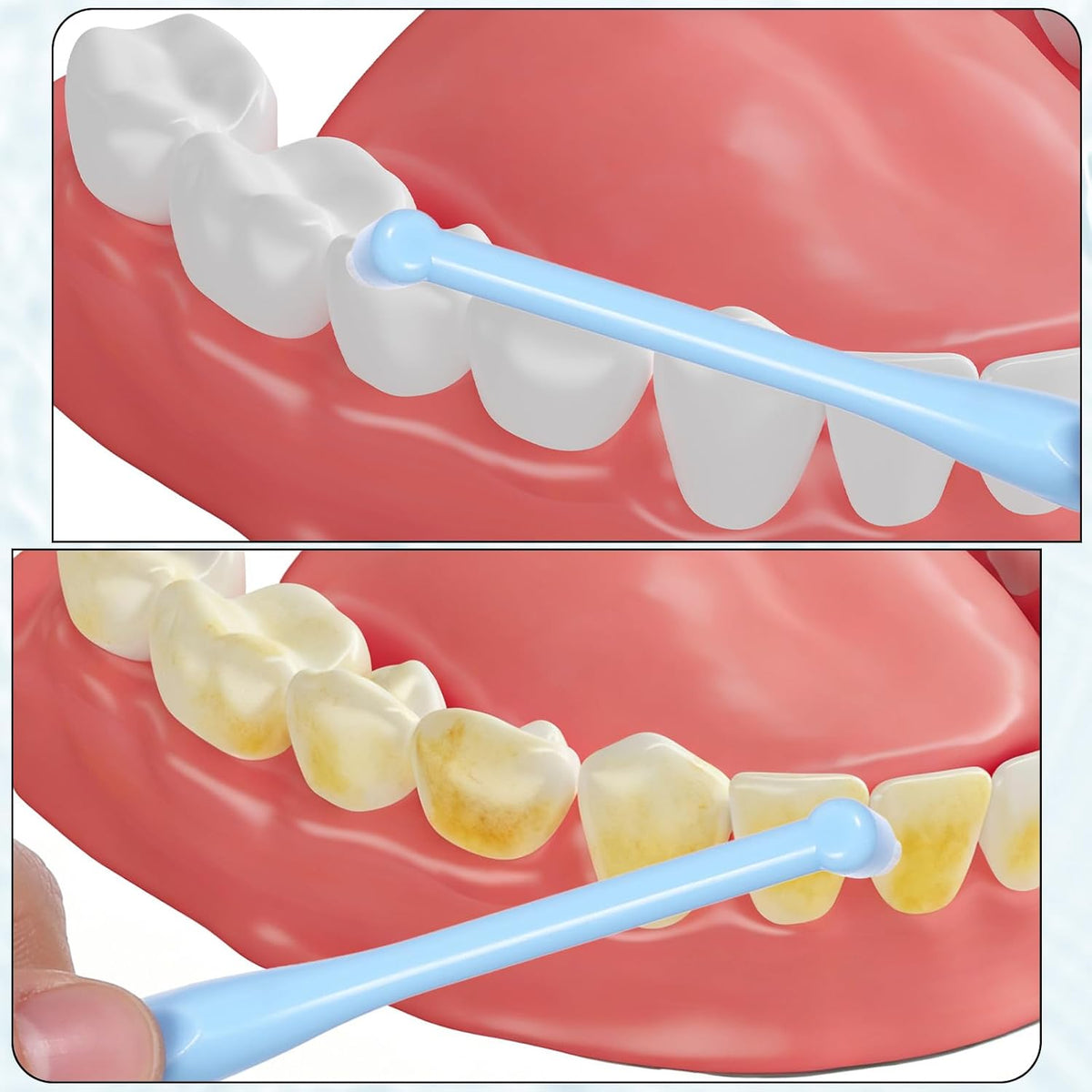 End-Tuft Orthodontic Detail Toothbrush Set encalife