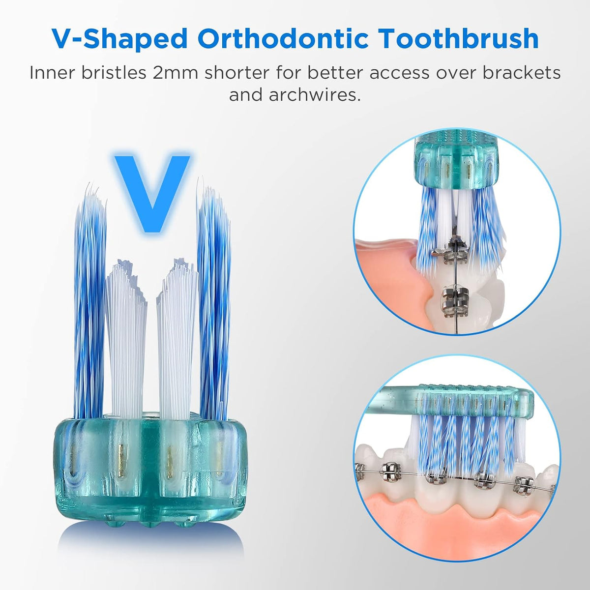 Orthodontic Toothbrush Set with Interdental Brushes encalife
