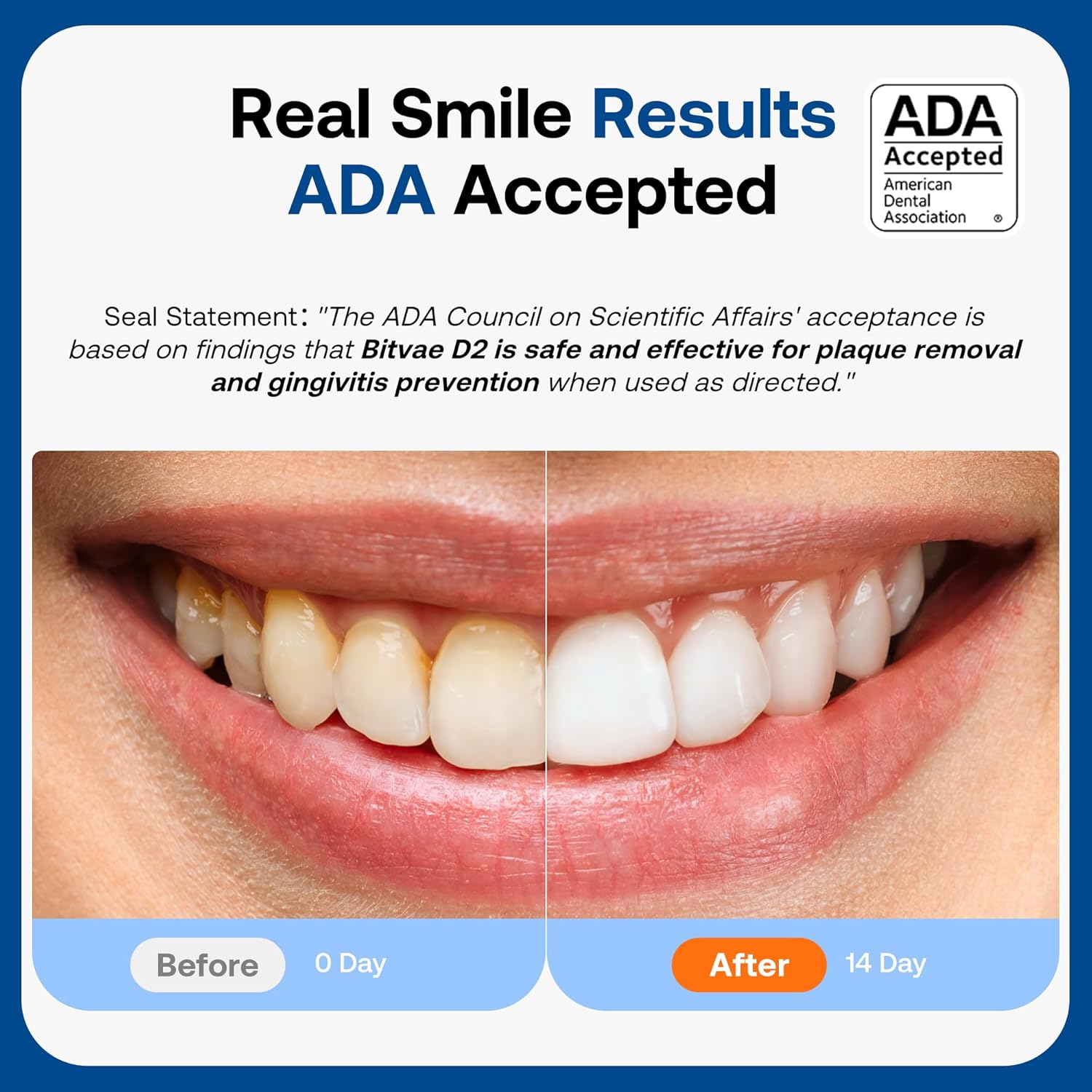 Bitvae ADA Rechargeable Travel Electric Toothbrush encalife